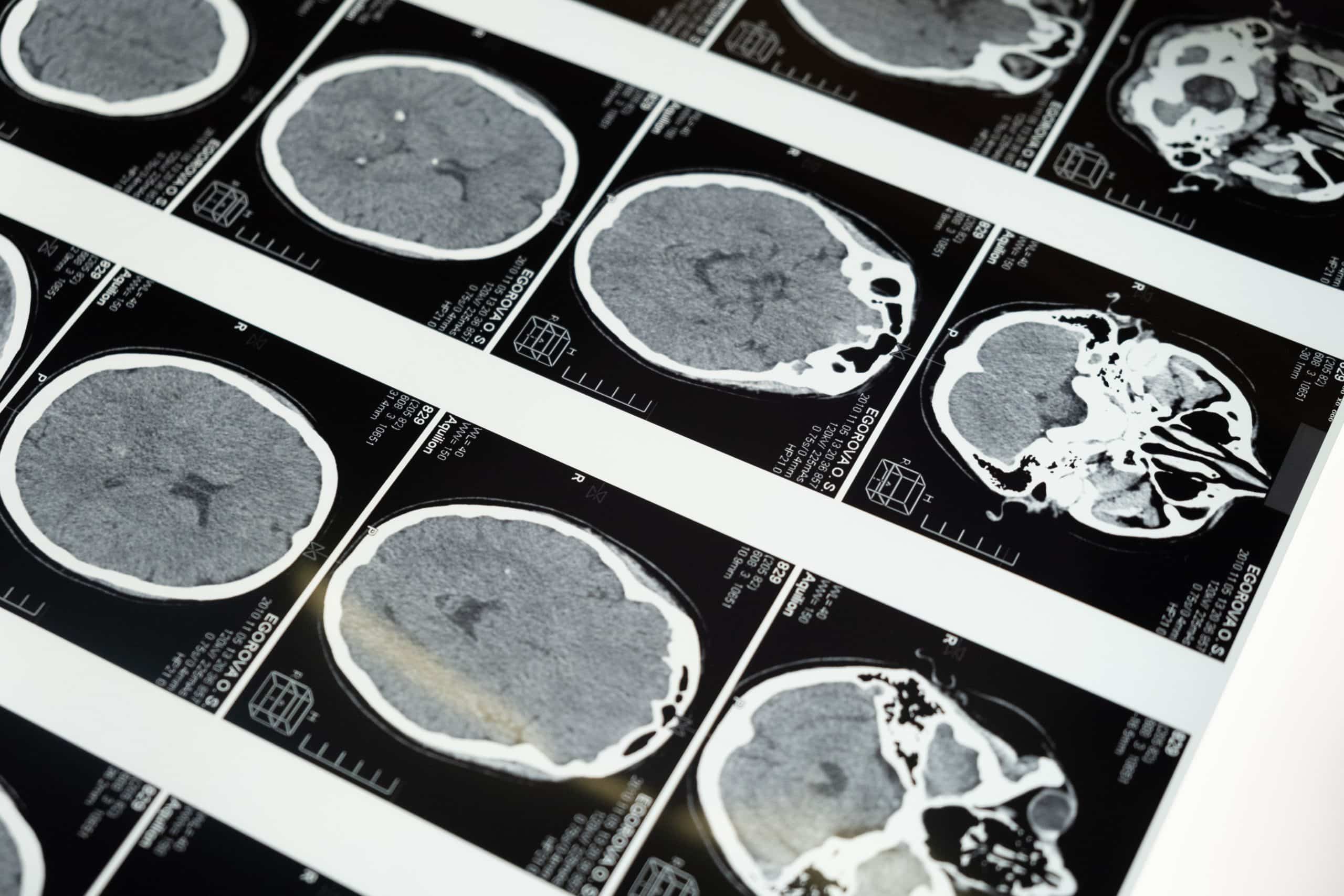 Work Your Legs, Strengthen Your Brain