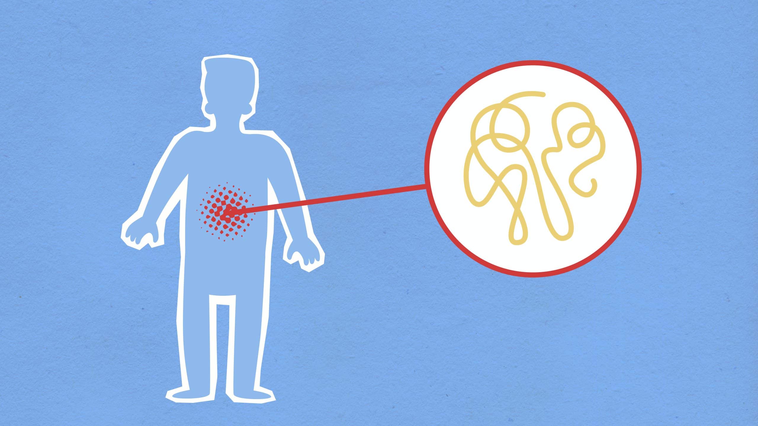 The Importance of C-Reactive Protein