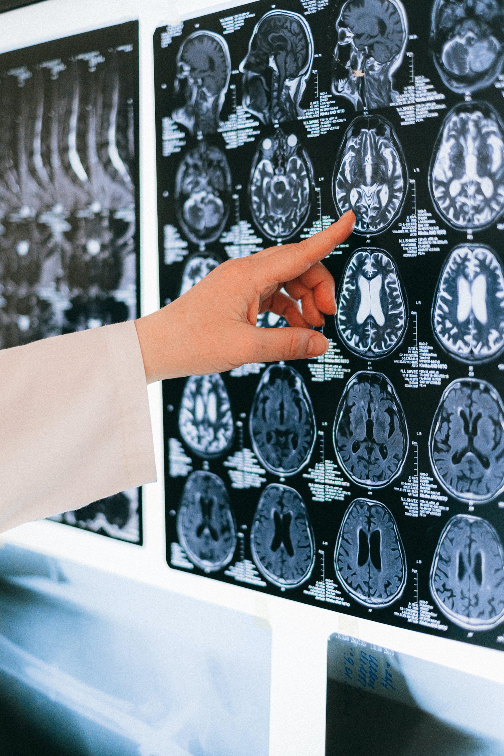 How to Rewire Our Brain: