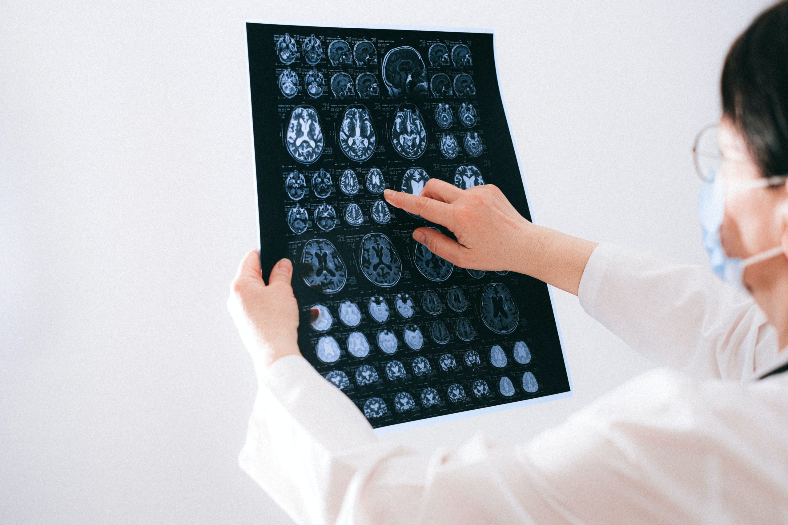 Why Is Brain Health So Important to Your Well-being?