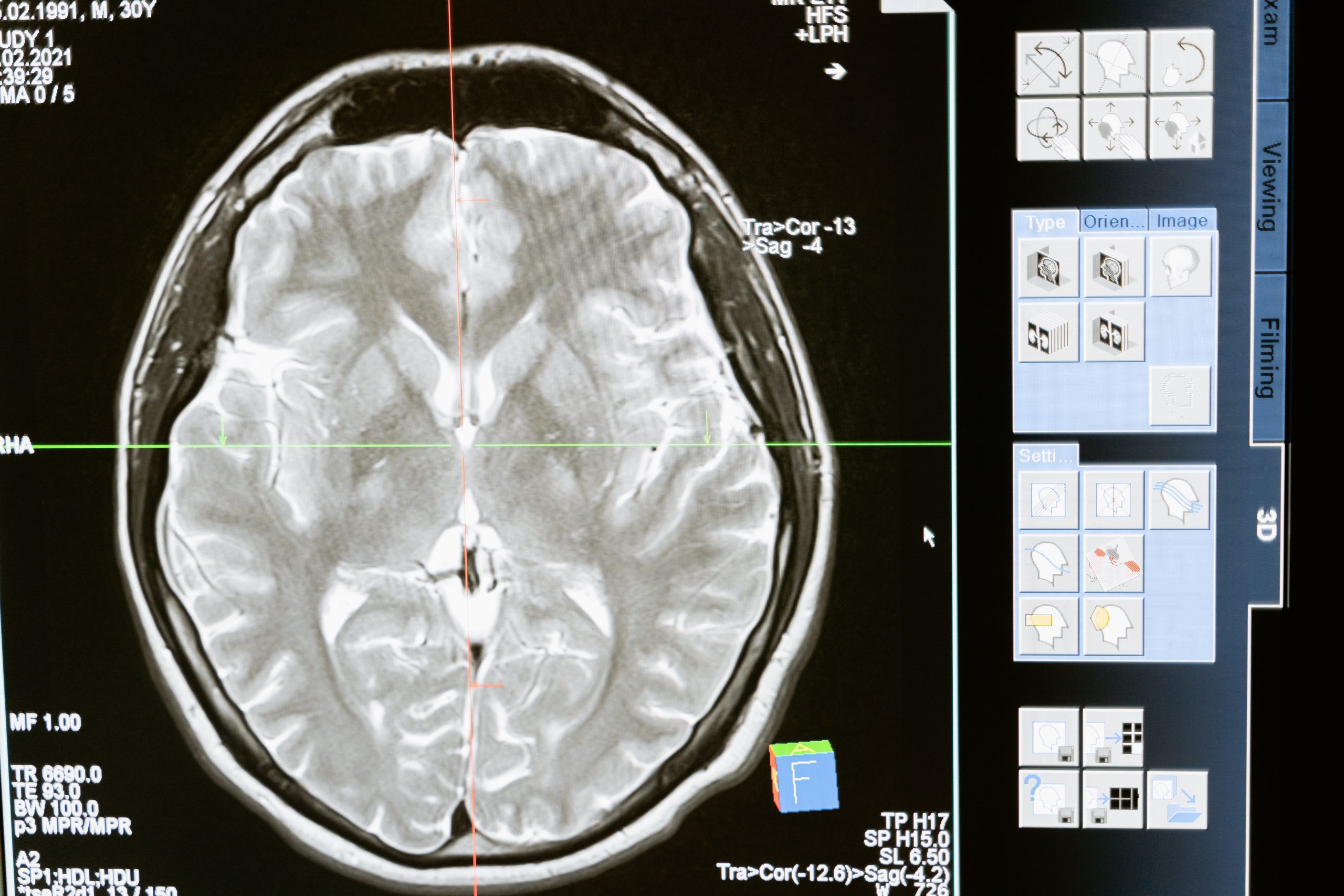 How to Improve Brain “Fitness”